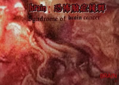 brain：Kongbu Nao Zheng Houqun cover