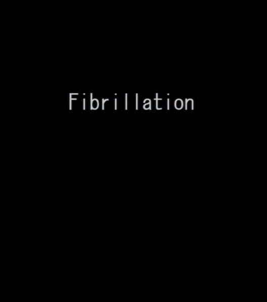 Fibrillation cover