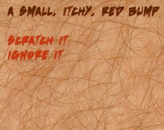 Itch cover